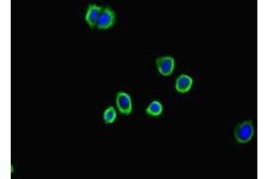 Immunofluorescent analysis of HepG2 cells using ABIN7143790 at dilution of 1:100 and Alexa Fluor 488-congugated AffiniPure Goat Anti-Rabbit IgG(H+L) (alpha 2 Macroglobulin anticorps  (AA 1216-1467))