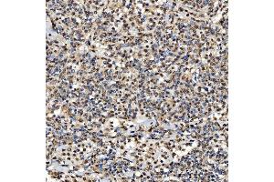 IHC analysis of SNRPD2 using anti-SNRPD2 antibody (ABIN7598963). (SNRPD2 anticorps  (AA 1-118))