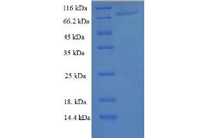 SDS-PAGE (SDS) image for Peroxisome Proliferator-Activated Receptor gamma (PPARG) (AA 1-477) protein (His-SUMO Tag) (ABIN5710133)