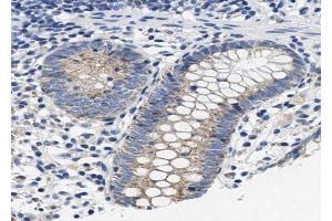 ABIN6267481 at 1/100 staining human colon tissue sections by IHC-P.