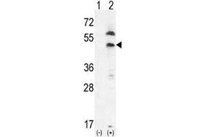 Western blot analysis of PDGFRL and 293 cell lysate either nontransfected (Lane 1) or transiently transfected (2) with the PDGFRL gene. (PDGFRL anticorps  (AA 328-357))