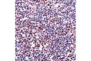 RUNX2 Antibody  ((ABIN392133 and ABIN2841871))immunohistochemistry analysis in formalin fixed and paraffin embedded human tonsil tissue followed by peroxidase conjugation of the secondary antibody and DAB staining.