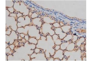 ABIN6267337 at 1/200 staining Mouse lung tissue sections by IHC-P.