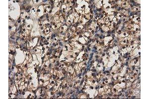 Immunohistochemistry (IHC) image for anti-Destrin (Actin Depolymerizing Factor) (DSTN) antibody (ABIN1497910) (Destrin anticorps)