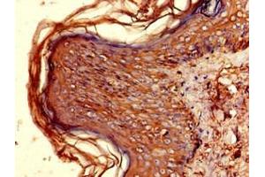 Immunohistochemistry of paraffin-embedded human skin tissue using ABIN7155597 at dilution of 1:100 (HLA-DQB1 anticorps  (AA 128-175))