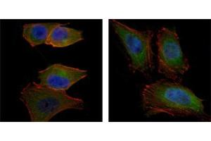 Immunofluorescence analysis of PANC-1 (left) and Hela (right) cells using AKT2 mouse mAb (green). (AKT2 anticorps)