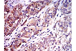 Immunohistochemistry (IHC) image for anti-Neurofilament, Light Polypeptide (NEFL) antibody (ABIN1108416) (NEFL anticorps)