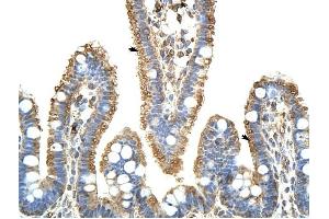 KARS antibody was used for immunohistochemistry at a concentration of 4-8 ug/ml to stain Epithelial cells of intestinal villus (arrows) in Human Intestine.