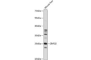Western blot analysis of extracts of mouse liver, using ZNF22 antibody (ABIN7271468) at 1:1000 dilution.