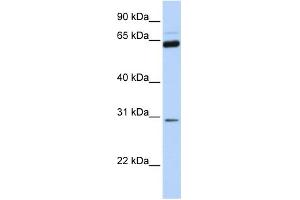 WB Suggested Anti-NEUROG1 Antibody Titration:  0. (Neurogenin 1 anticorps  (C-Term))