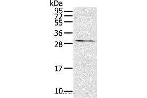 Western blot analysis of Mouse kidney tissue, using TNFSF15 Polyclonal Antibody at dilution of 1:600 (TNFSF15 anticorps)