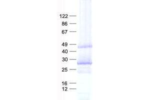 Validation with Western Blot (MAB21L1 Protein (His tag))