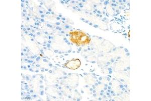 Immunohistochemistry of paraffin embedded rat pancreatic using MADCAM1 (ABIN7074695) at dilution of 1:1800 (400x lens) (MADCAM1 anticorps)