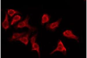 ABIN6276173 staining Hela by IF/ICC. (OR5M9 anticorps  (Internal Region))