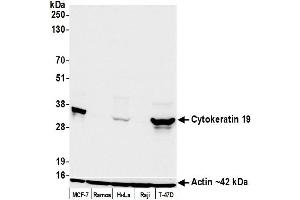 Western Blotting (WB) image for anti-Keratin 19 (KRT19) antibody (ABIN7449419)
