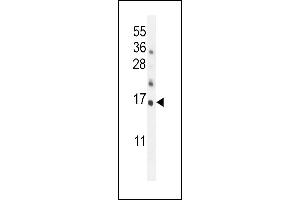Hrk-BH3 (ABIN388104 and ABIN2846212) western blot analysis in mouse kidney tissue lysates (35 μg/lane). (HRK anticorps  (AA 15-50))