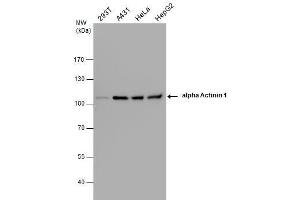 WB Image alpha Actinin 1 antibody detects alpha Actinin 1 protein by western blot analysis. (ACTN1 anticorps)