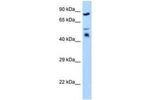 Image no. 1 for anti-Testis Derived Transcript (3 LIM Domains) (TES) (AA 203-252) antibody (ABIN6748070)