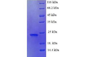 BETAT (AA 16-198) protein (His tag)