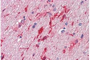 Human Brain, Cerebellum, White Matter (formalin-fixed, paraffin-embedded) stained with HGF antibody ABIN461958 at 10 ug/ml followed by biotinylated anti-mouse IgG secondary antibody ABIN481714, alkaline phosphatase-streptavidin and chromogen. (HGF anticorps)