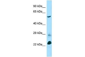 Host: Rabbit Target Name: Btbd3 Sample Type: Mouse Lung lysates Antibody Dilution: 1. (BTBD3 anticorps  (C-Term))