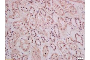 Formalin-fixed and paraffin embedded human kidney tissue labeled with Anti-THEMIS Polyclonal Antibody, Unconjugated 1:400 followed by conjugation to the secondary antibody and DAB staining (THEMIS anticorps  (AA 301-400))