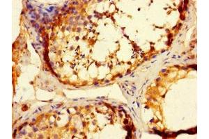Immunohistochemistry of paraffin-embedded human testis tissue using ABIN7173195 at dilution of 1:100 (TMEM27 anticorps  (AA 206-265))