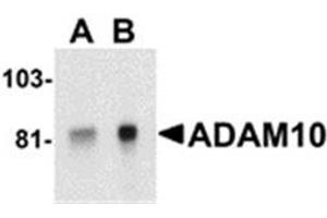 Image no. 1 for anti-ADAM Metallopeptidase Domain 10 (ADAM10) (AA 732-748) antibody (ABIN319033)