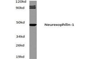 Western blot (WB) analysis of Neurexophilin-1 antibody in extracts from A549 cells at 1/500 dilution.