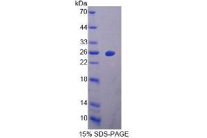 SDS-PAGE of Protein Standard from the Kit  (Highly purified E.