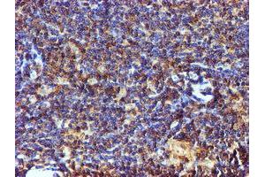 Image no. 13 for anti-Chromosome 1 Open Reading Frame 50 (C1ORF50) antibody (ABIN1497033)