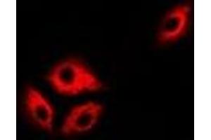 Immunofluorescent analysis of ASL staining in Hela cells. (ASL anticorps)