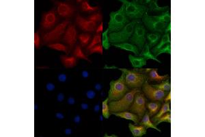 Bcl-2 Antibody staining Hela cells by IF/ICC.