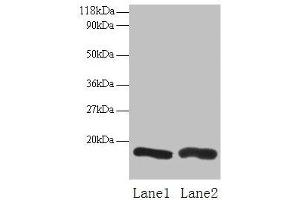 Western blot All lanes: CHMP2A antibody at 2 μg/mL Lane 1: EC109 whole cell lysate Lane 2: 293T whole cell lysate Secondary Goat polyclonal to rabbit IgG at 1/15000 dilution Predicted band size: 26 kDa Observed band size: 16 kDa (CHMP2A anticorps  (AA 1-222))