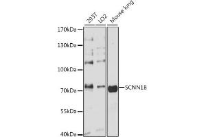 Western blot analysis of extracts of various cell lines, using SCNN1B antibody (ABIN3022509, ABIN3022510, ABIN1513502 and ABIN6218866) at 1:3000 dilution. (SCNN1B anticorps  (AA 406-640))