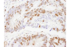 Immunohistochemistry (IHC) image for anti-Zinc Finger Protein 295 (ZNF295) (AA 875-925) antibody (ABIN7448882)