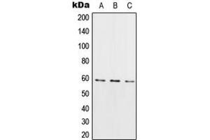 Western blot analysis of RIOK3 expression in HeLa (A), Raw264. (RIOK3 anticorps  (Center))