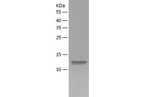 Western Blotting (WB) image for Potassium Channel, Subfamily V, Member 2 (KCNV2) (AA 12-154) protein (His-IF2DI Tag) (ABIN7124532)