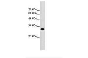 Image no. 2 for anti-Ring Finger Protein 121 (RNF121) (AA 101-150) antibody (ABIN203520) (RNF121 anticorps  (AA 101-150))