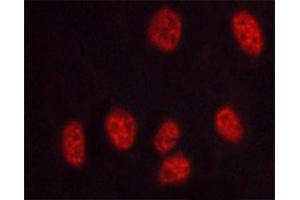 ABIN6267569 staining HUVEC cells treated with serum 20% 30' by ICC/IF. (PRKDC anticorps  (pThr2647))