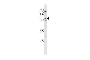 Western blot analysis in HL-60 cell line lysates (35ug/lane). (Lipoprotein Lipase anticorps  (AA 300-327))