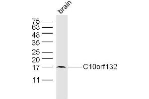 Mouse brain lysates probed with C10orf132 Polyclonal Antibody, Unconjugated  at 1:300 dilution and 4˚C overnight incubation. (GOLGA7B anticorps)