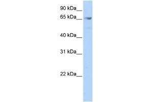 WB Suggested Anti-MEF2A Antibody Titration:  0. (MEF2A anticorps  (Middle Region))