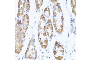 Immunohistochemistry of paraffin-embedded human stomach using ATG5 antibody. (ATG5 anticorps  (AA 1-275))