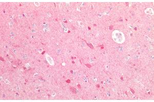 Detection of UBQLN2 in Human Brain Tissue using Polyclonal Antibody to Ubiquilin 2 (UBQLN2)