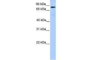 C12ORF40 antibody used at 1 ug/ml to detect target protein. (C12orf40 anticorps  (N-Term))