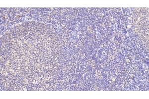 Detection of TFR in Porcine Lymph node Tissue using Polyclonal Antibody to Transferrin Receptor (TFR) (Transferrin Receptor anticorps  (AA 578-765))