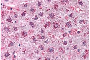 Human Liver (formalin-fixed, paraffin-embedded) stained with CAT antibody ABIN214024 at 5 ug/ml followed by biotinylated goat anti-rabbit IgG secondary antibody ABIN481713, alkaline phosphatase-streptavidin and chromogen. (Catalase anticorps)