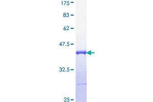 Image no. 1 for Interferon Regulatory Factor 5 (IRF5) (AA 395-504) protein (GST tag) (ABIN1308092)