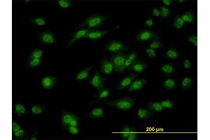 Immunofluorescence of monoclonal antibody to DLX1 on HeLa cell.